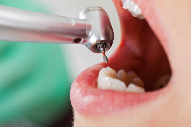 Best Pediatric Emergency Dentist in Deadwood, SD